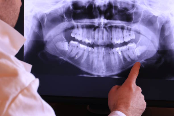 Best Emergency Dental Surgery in Darmstadt, IN