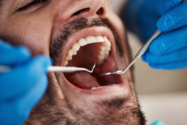 Best Same-Day Emergency Dentist in Darmstadt, IN